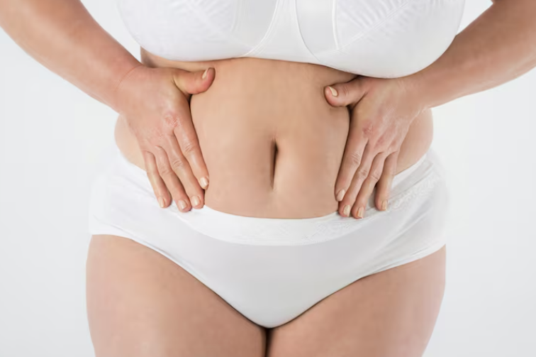지방흡입가격, 지방을 많이 뺄수록 비용도 올라갈까요? 관련 이미지 3