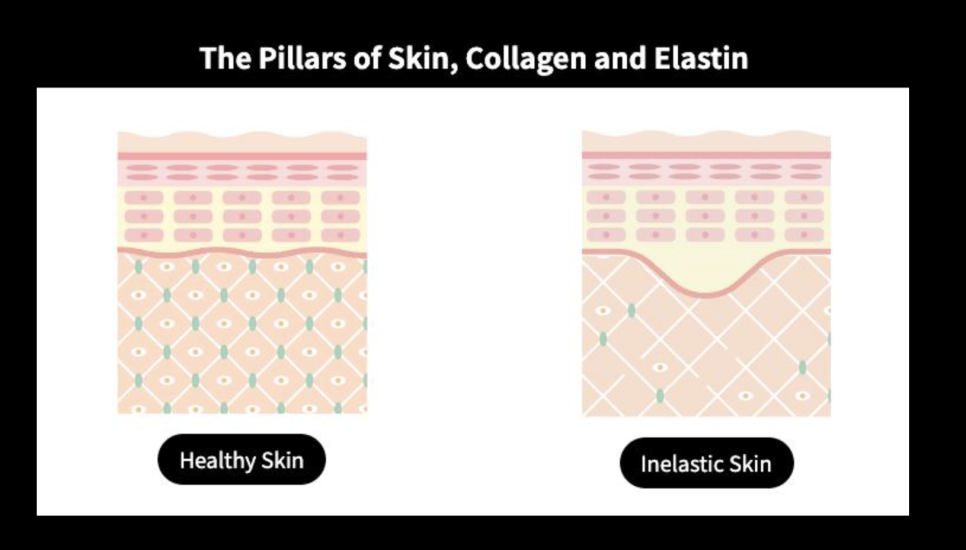 Abdominal Liposuction Price·Side Effects·Bruising: 3 Things to Check During a Consultation at a Gangnam Plastic Surgery Clinic image 4