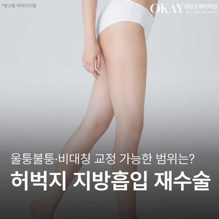 허벅지지방흡입재수술, 결과가 만족스럽지 않을 때 교정 가능한 범위는? 관련 이미지 1