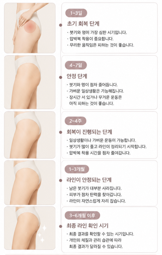 Why Satisfaction Differs After Thigh Liposuction: What You Miss When You Focus Only on the Inner Thighs image 10