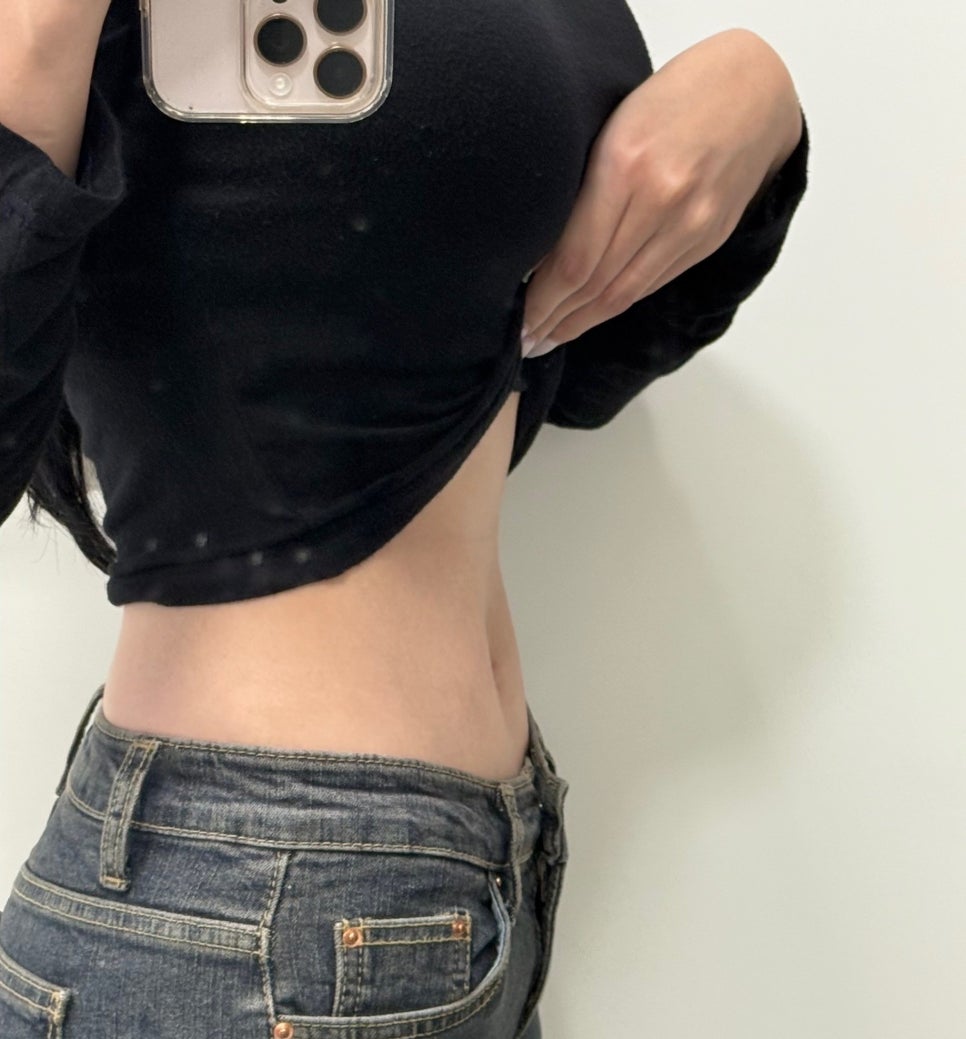 복부지방흡입 잘하는곳 찾는다면, 흉터 고민과 얼마나 뽑아야 할까? 허리 라인 정리 관련 이미지 8