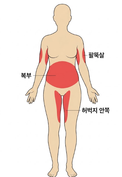 지방흡입수술비용, 가격보다 먼저 확인해야 할 것은? 관련 이미지 3