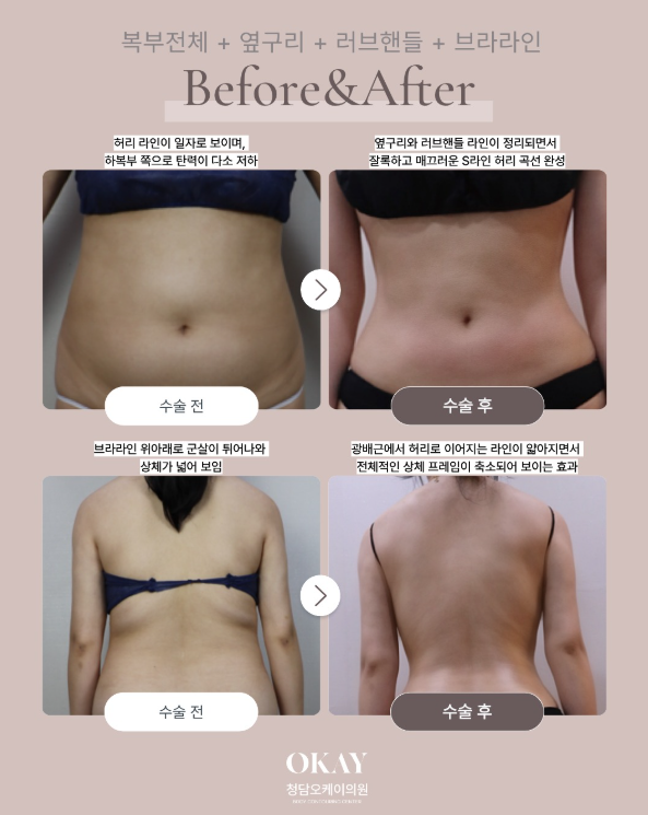 옆구리살빼는법, 유독 러브핸들만 안 빠지는 이유는? 관련 이미지 9