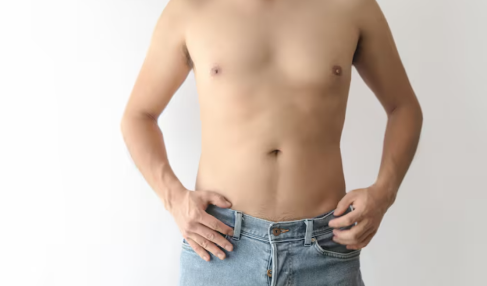 남자지방흡입, 술배처럼 나온 복부 어디까지 줄일 수 있을까요? 관련 이미지 2