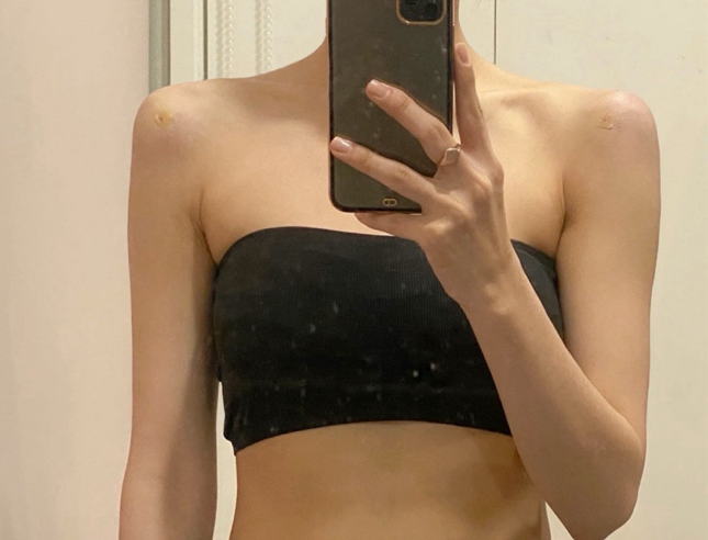 Creating a JENNIE Shoulder Filler Line: How to Enhance It Without Overdoing It image 9