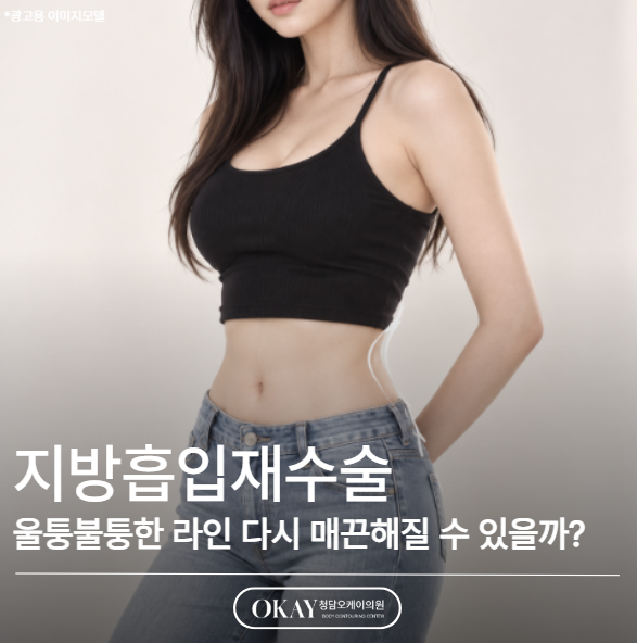 지방흡입재수술, 울퉁불퉁한 라인 다시 매끈해질 수 있을까? 관련 이미지 1