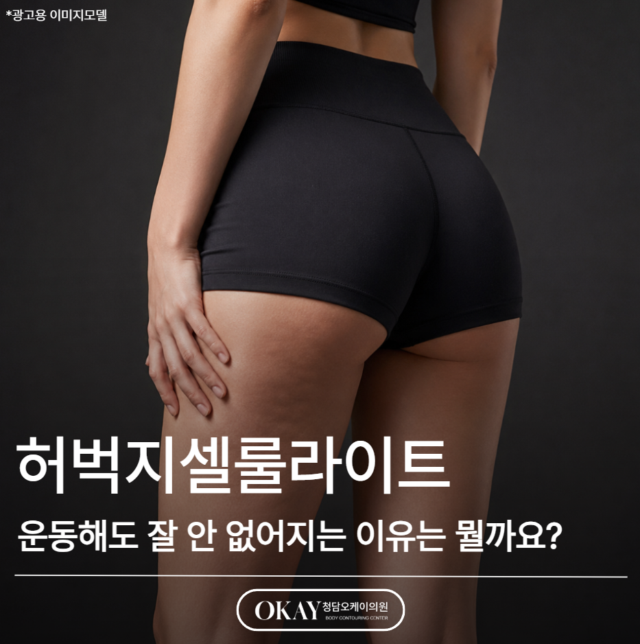 허벅지셀룰라이트, 운동해도 잘 안 없어지는 이유는 뭘까요? 관련 이미지 1