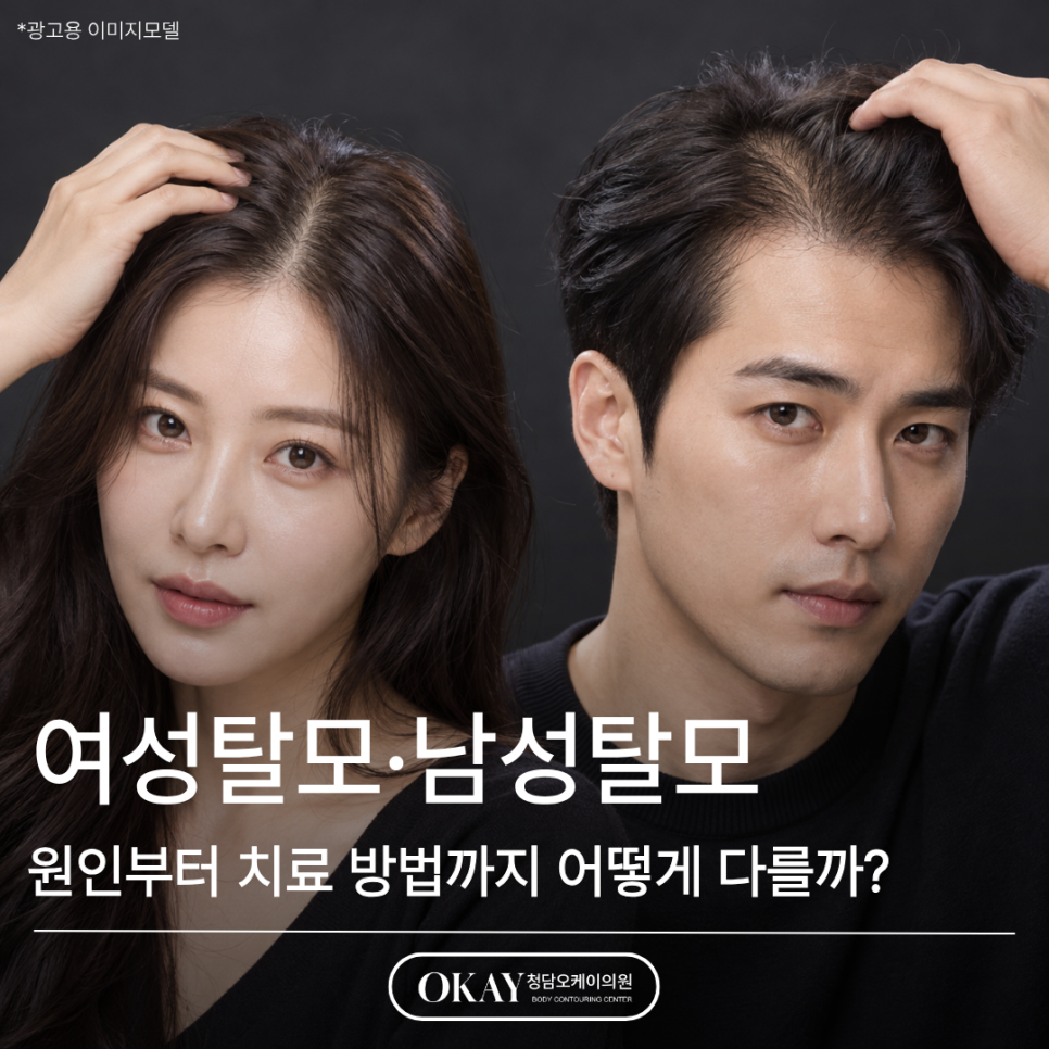 여성탈모&middot;남성탈모, 원인부터 치료 방법까지 어떻게 다를까? 관련 이미지 2