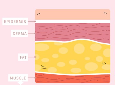 서울 남자얼굴지방흡입 효과 있을까? 턱살&middot;윤곽이 다이어트로 안되는 이유와 가격 관련 이미지 3
