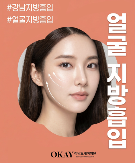 서울지방이식잘하는곳, 자연스러운 얼굴 라인을 만드는 차이 관련 이미지 10