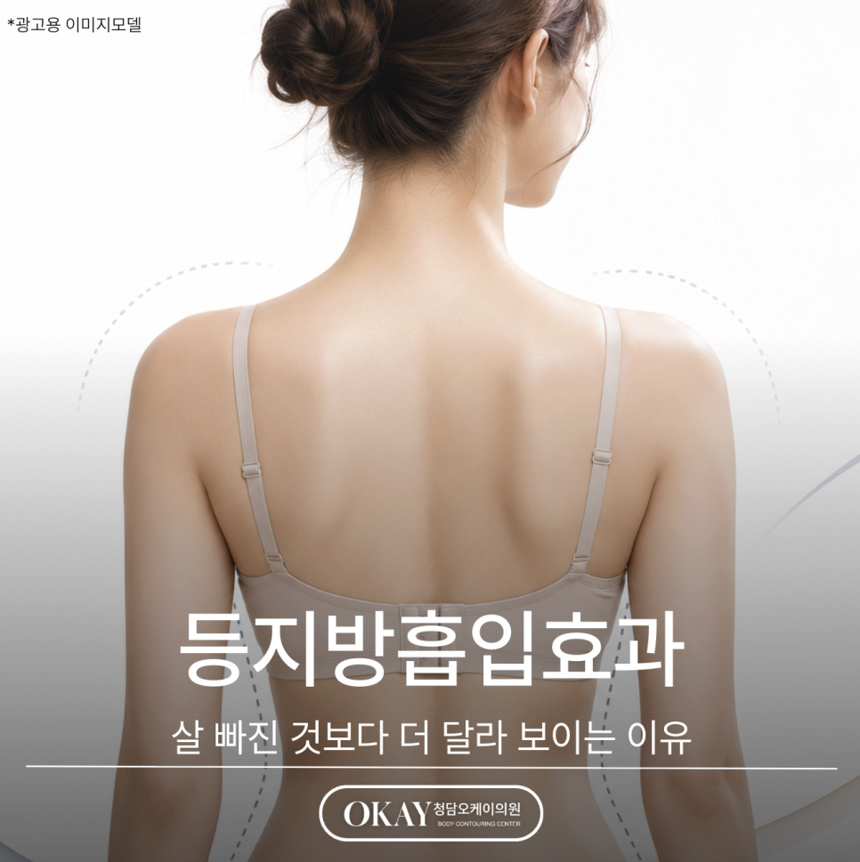 등지방흡입효과, 살 빠진 것보다 더 달라 보이는 이유 관련 이미지 1