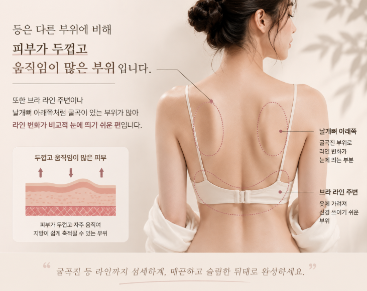 What to Check If You Are Concerned About Unevenness After Back Liposuction image 3