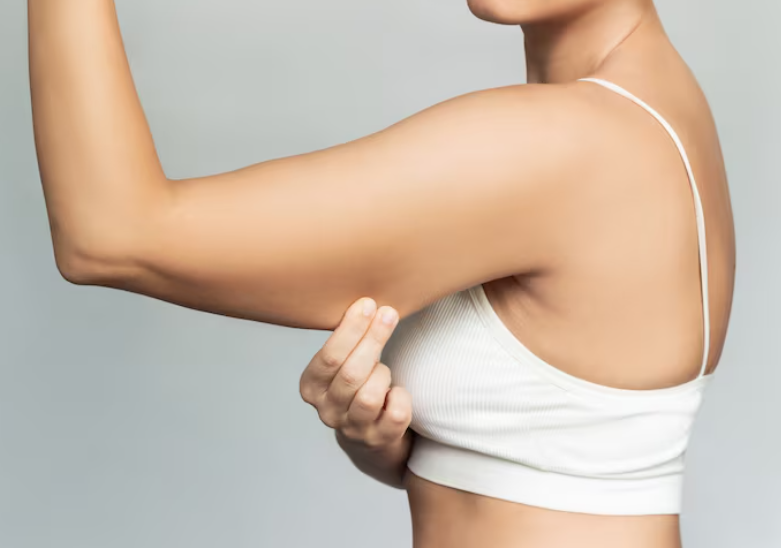 팔뚝지방흡입수술비용, 겨드랑이·부유방까지 하면 얼마나 달라질까? 관련 이미지 9