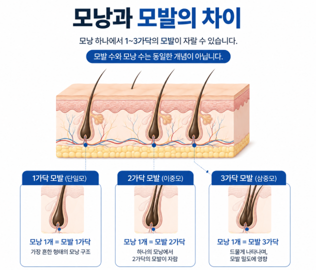 How Much Can 3,000 Hair Grafts Cover? image 3
