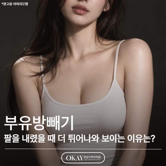부유방빼기, 팔을 내렸을 때 더 튀어나와 보이는 이유는? 관련 이미지 1