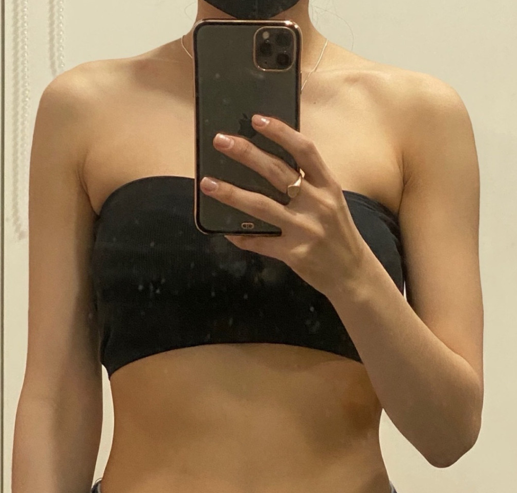 Creating a JENNIE Shoulder Filler Line: How to Enhance It Without Overdoing It image 8