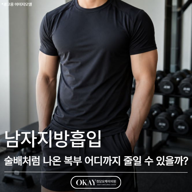 남자지방흡입, 술배처럼 나온 복부 어디까지 줄일 수 있을까요? 관련 이미지 1