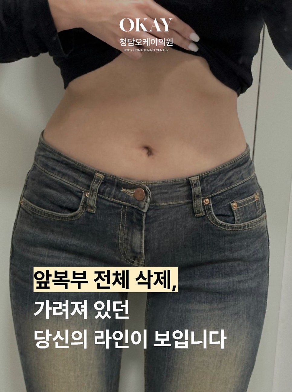 지방흡입붓기 언제 빠질까? 1주&middot;1개월&middot;3개월 회복 과정 정리 관련 이미지 7