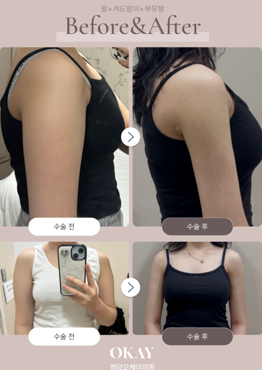 강남역지흡잘하는곳 찾기 전, 체형에 맞는 디자인이 중요한 이유 관련 이미지 5