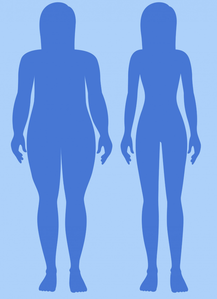 What to Check Before Looking at Arm Liposuction Reviews and Prices image 4