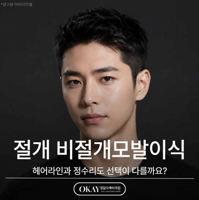 절개 비절개모발이식, 헤어라인과 정수리도 선택이 다를까요? 관련 이미지 1