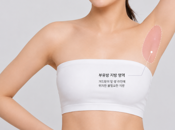 상체살빼기, 지방흡입 후 팔뚝&middot;등라인은 얼마나 달라질까요? 관련 이미지 5
