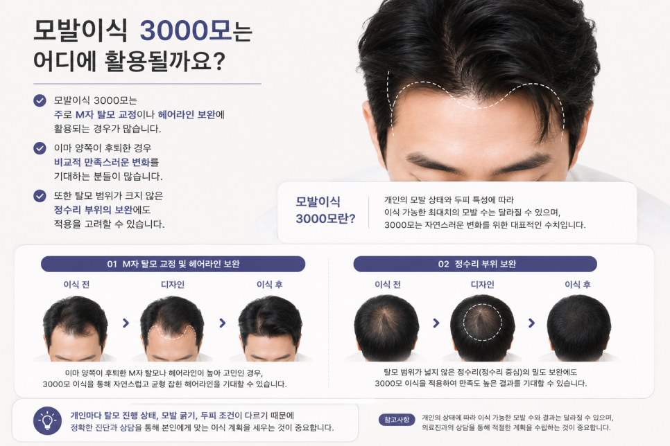 Is 3,000 Grafts Enough for a Hair Transplant? A Complete Guide from Design to Coverage image 4