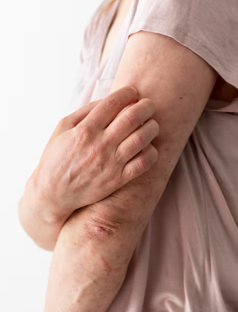 Post-Liposuction Lumpiness Management: Essential Care Tips for Reducing Hardness image 10