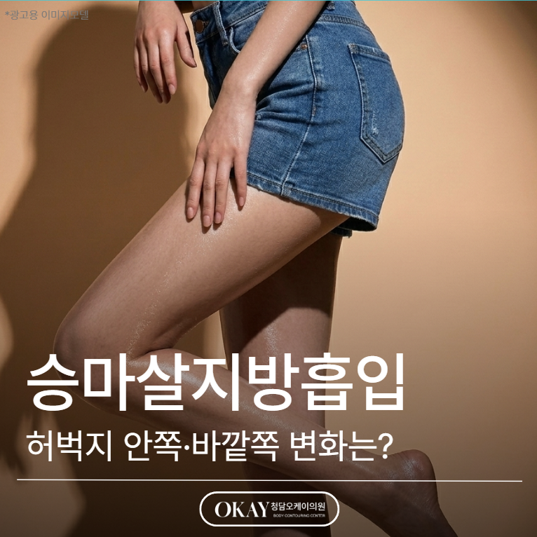 승마살지방흡입 효과 얼마나 다를까? 허벅지 안쪽&middot;바깥쪽 변화 기준 정리 관련 이미지 1