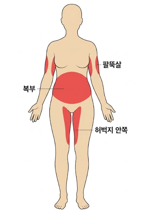 허리살빼기, 지방흡입 후 허리라인은 얼마나 달라질까요? 관련 이미지 4