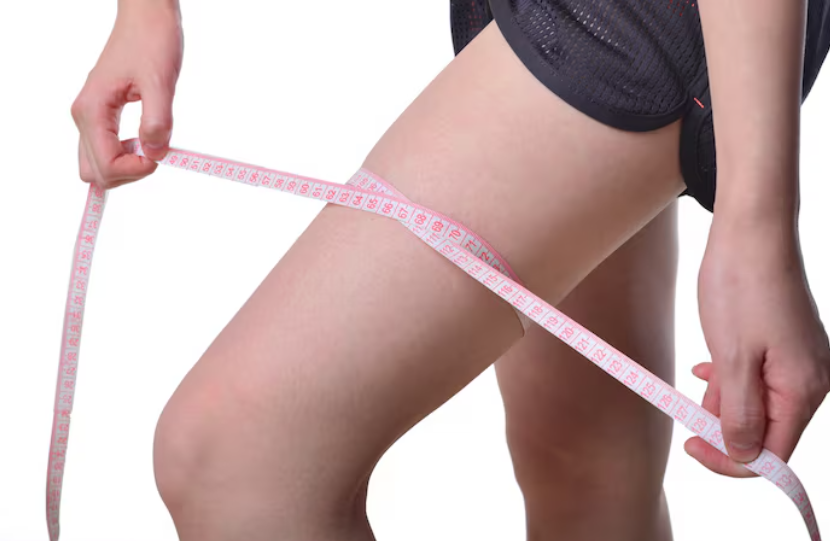 Thigh Liposuction: What If Your Thighs Don’t Slim Down Even with Exercise? image 7