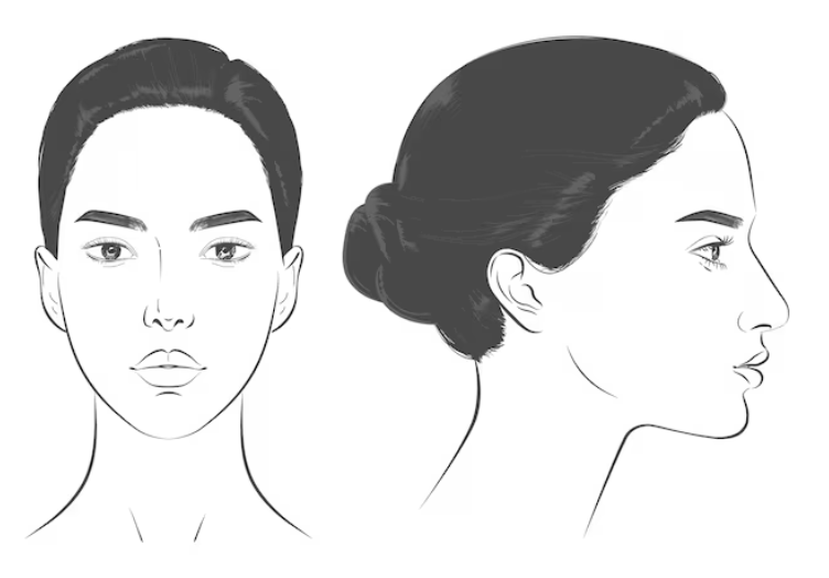 Long-Face Fat Grafting: Satisfaction Depends on Considering Facial Proportions image 4