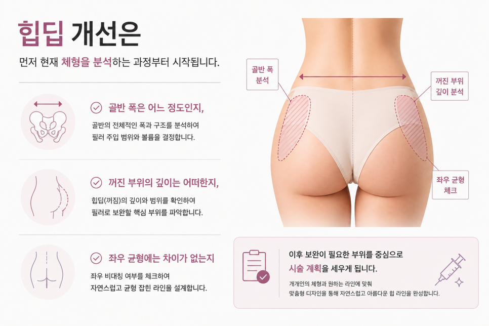 엉덩이필러후기, 부작용·유지기간·만족도까지 확인해보세요 관련 이미지 3