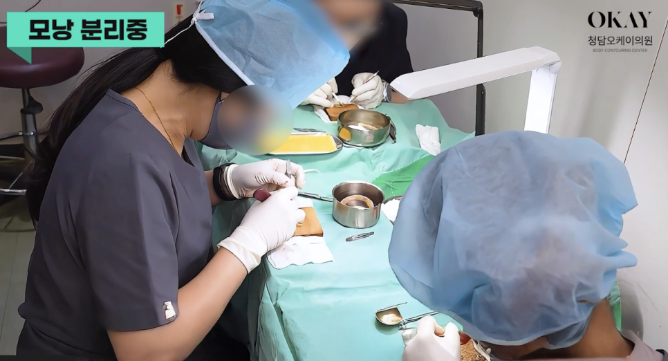 여자모발이식잘하는곳, 헤어라인 모발이식 병원 선택할 때 꼭 봐야 할 기준 관련 이미지 7
