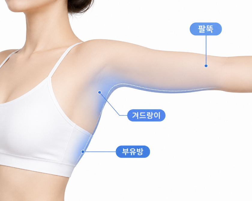 Forearm Liposuction: How Design Differs by Body Type image 6