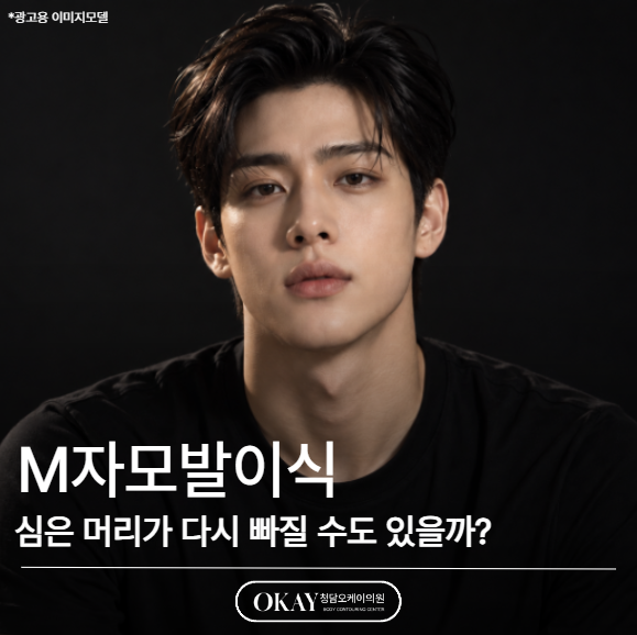 M자모발이식, 심은 머리가 다시 빠질 수도 있을까? 관련 이미지 1