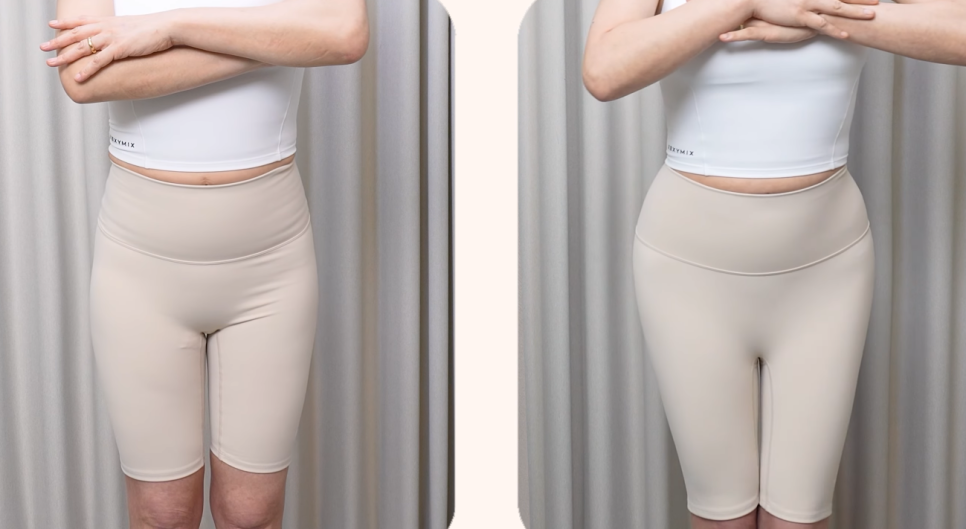힙필러 수술 없이 애플힙 가능할까 힙딥 개선과 라인 변화 기준 정리 관련 이미지 9