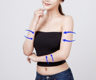 팔뚝지방흡입수술비용 얼마일까 부작용과 추가 비용 확인해야 할 것 관련 이미지 9