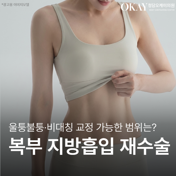 복부지방흡입재수술, 울퉁불퉁&middot;비대칭 교정 가능한 범위 설명드립니다 관련 이미지 1
