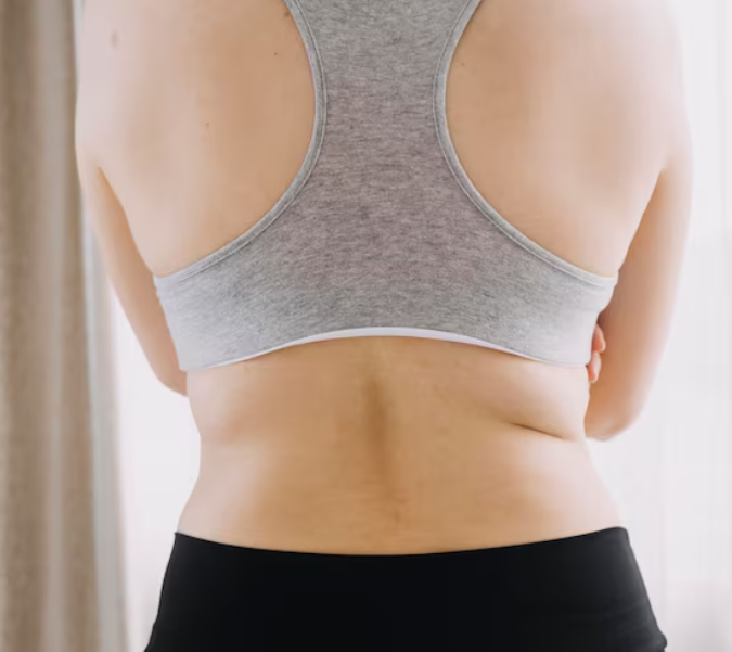 Flat Waist Liposuction: How to Make the Waist Slimmer and Compression Garments After Liposuction image 2