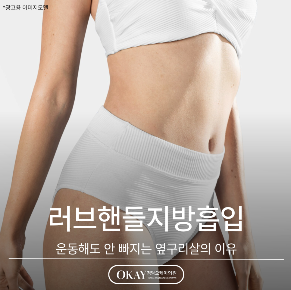Love Handle Liposuction: Why Side Fat Does Not Go Away Even with Exercise image 1