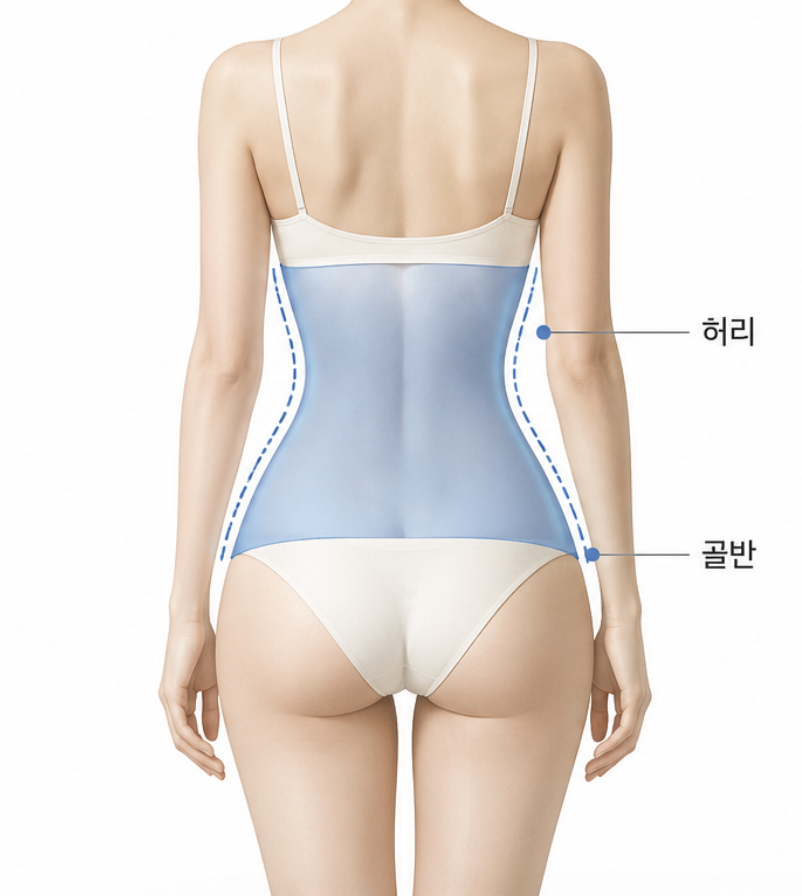 What Is the Waist-Hip Ring Procedure, and How Does It Differ from Liposuction? image 3