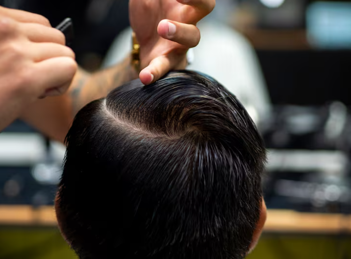 Hair Transplant Take-In Period: When Will the Grafts Fully Settle? A Complete Overview of Changes by Stage image 11