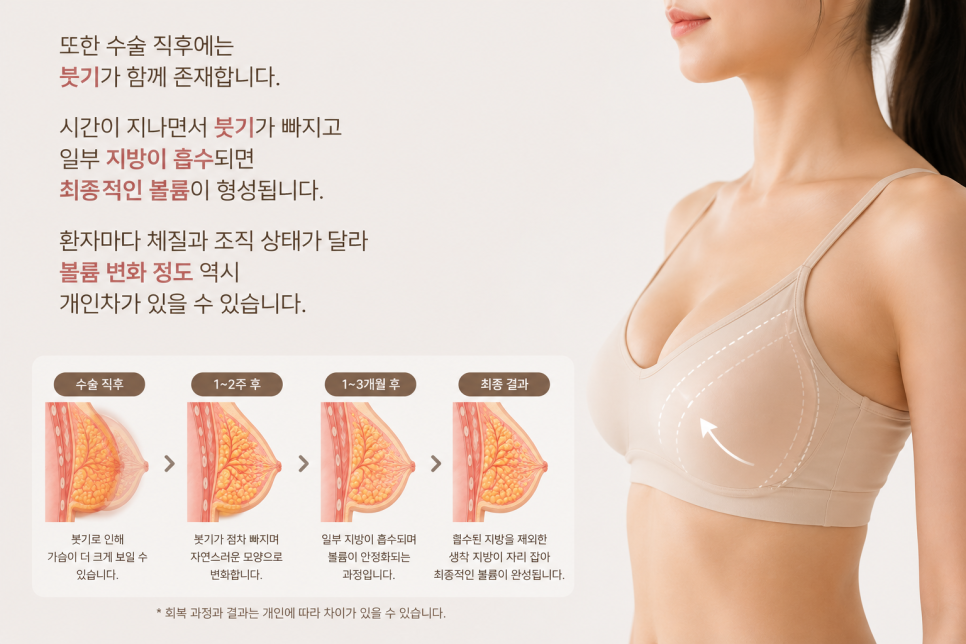 가슴지방이식 후 볼륨이 줄어드는 이유 알려드립니다 관련 이미지 6