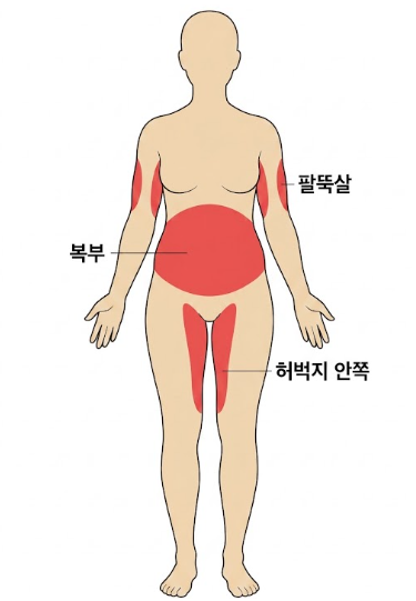 강남지방흡입병원, 체중보다 ‘라인’을 먼저 봐야 하는 이유 관련 이미지 3