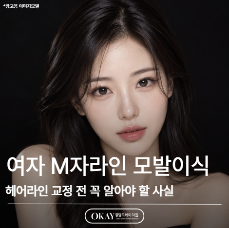 여자 M자라인 모발이식, 헤어라인 교정 전 꼭 알아야 할 사실 관련 이미지 1