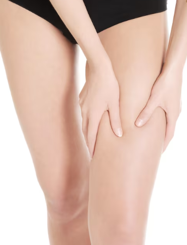 허벅지지방흡입, 다이어트해도 허벅지만 안 빠지는 이유는? 관련 이미지 2