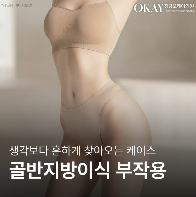 골반지방이식 후 부작용, 생각보다 흔한 케이스는 이것입니다 관련 이미지 1