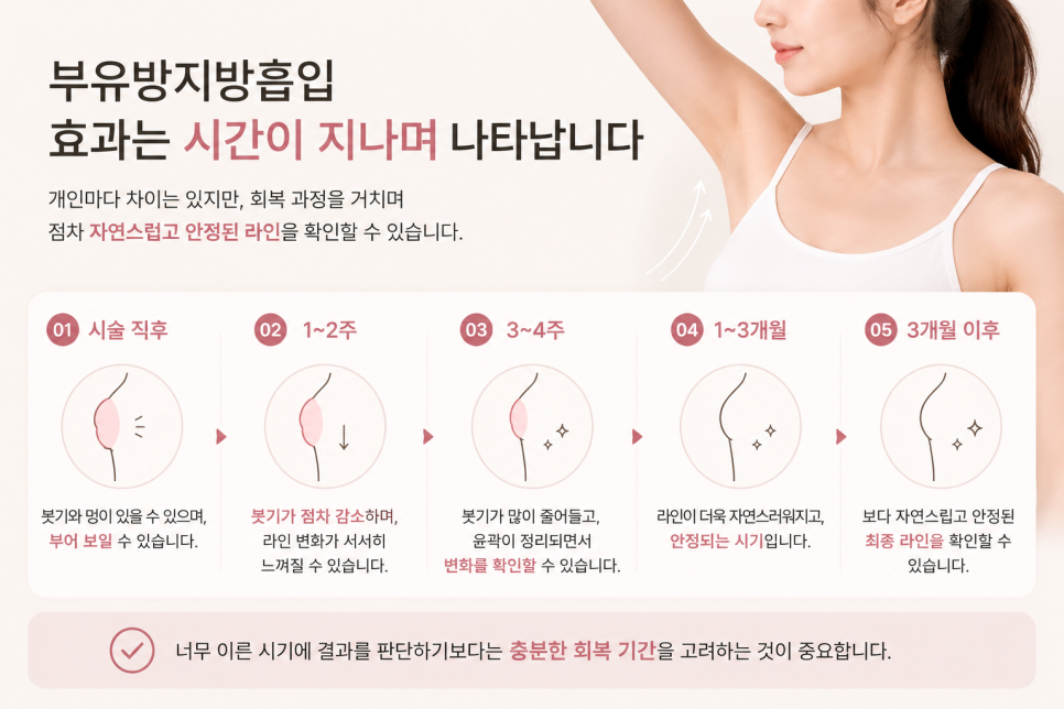 부유방지방흡입 효과 언제부터 보일까? 붓기·부작용·회복기간 총정리 관련 이미지 5