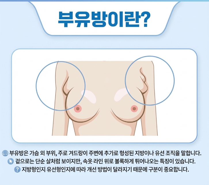여자 부유방 vs 남자 부유방, 지방 vs 유선 차이부터 확인하세요 관련 이미지 4